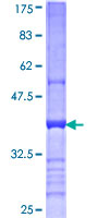 12.5% SDS-PAGE Stained with Coomassie Blue.